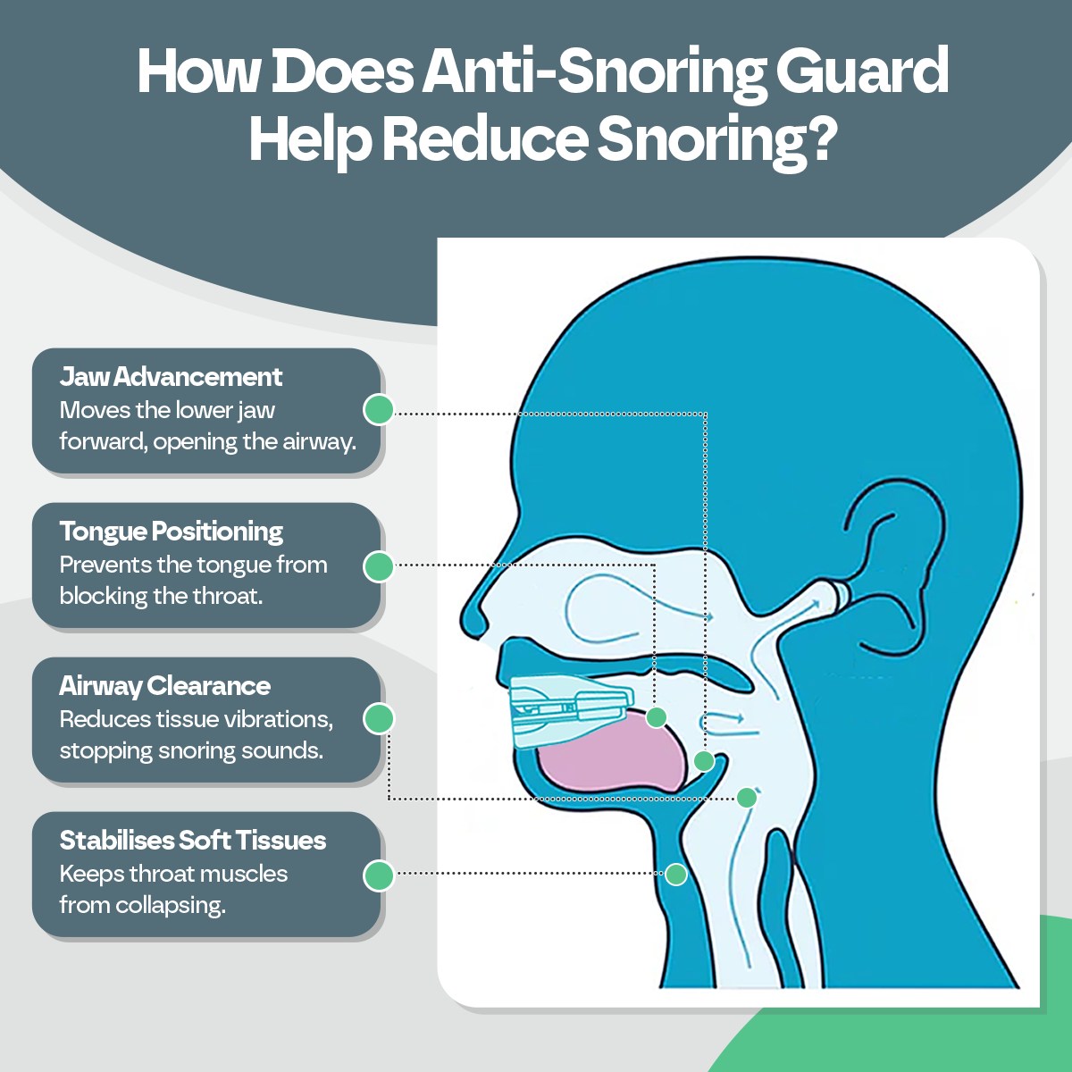 Anti Snoring Mouth Guard for Better Sleep