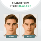 Snooze Therapy Jaw Exerciser & Jawline Muscle Trainer (3 Levels)