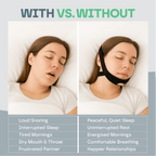 Anti-Snoring Chin Strap for Better Sleep and Snore Relief