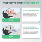 Sleep Guard Pro Mouth Guard for Anti-Grinding & Jaw Protection