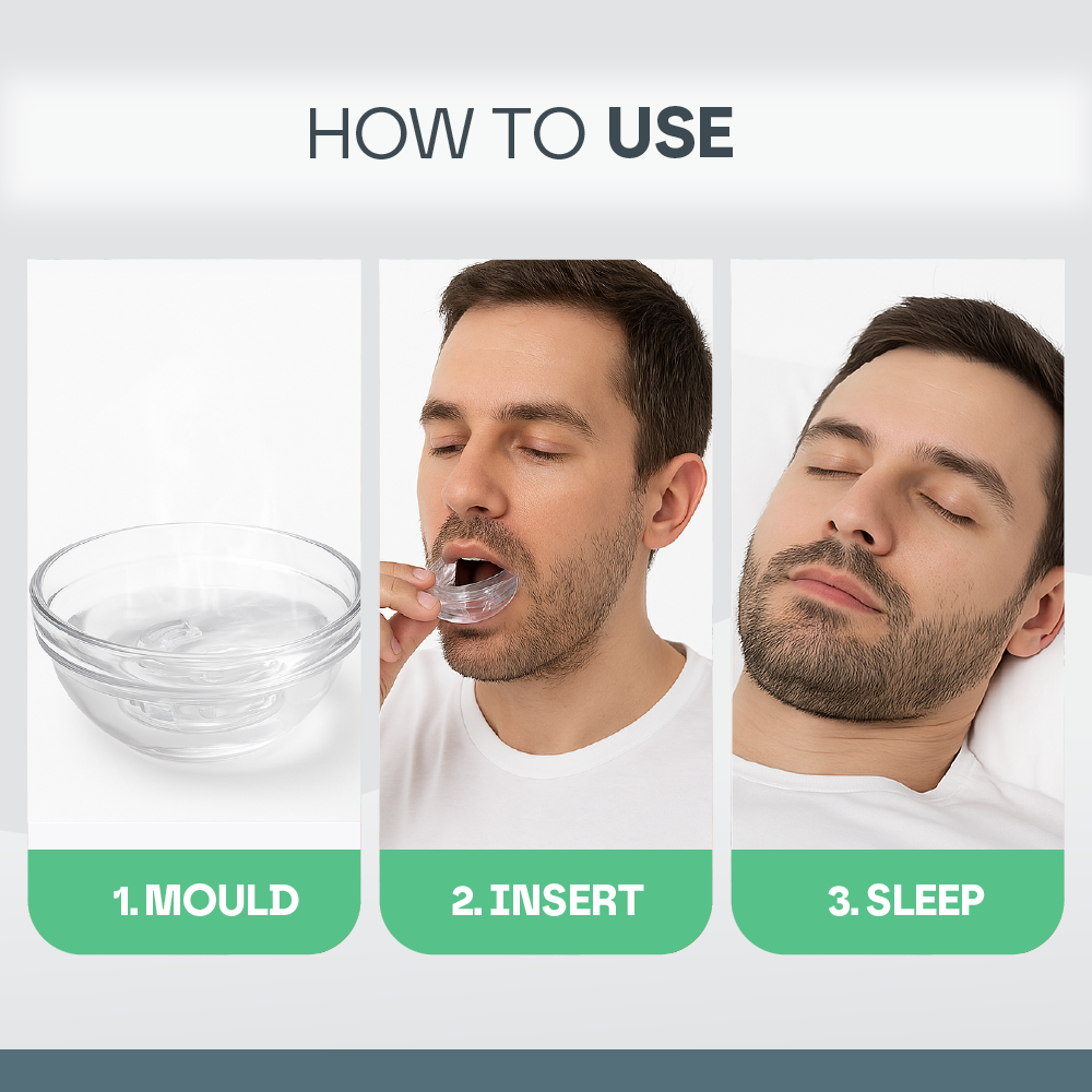 Sleep Guard Pro Mouth Guard for Anti-Grinding & Jaw Protection
