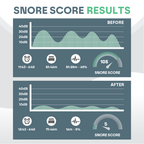 Sleep Guard Pro Mouth Guard for Anti-Grinding & Jaw Protection